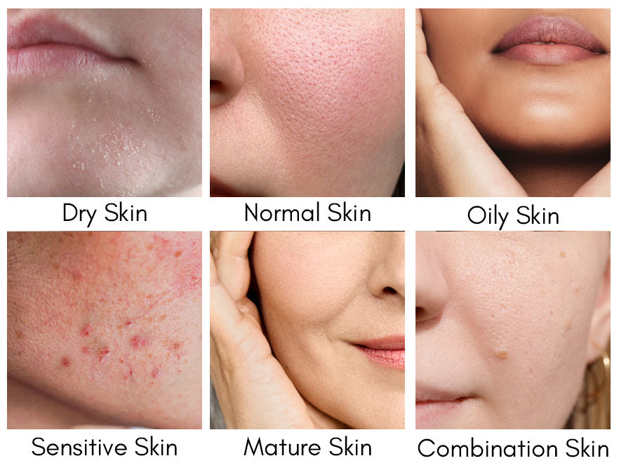 How to Recognize Your Skin Type