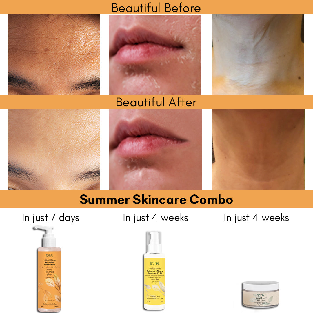 Summer Starter Kit (Probiotic Face Wash & Mineral Moisturizer + SPF & Neck Cream)